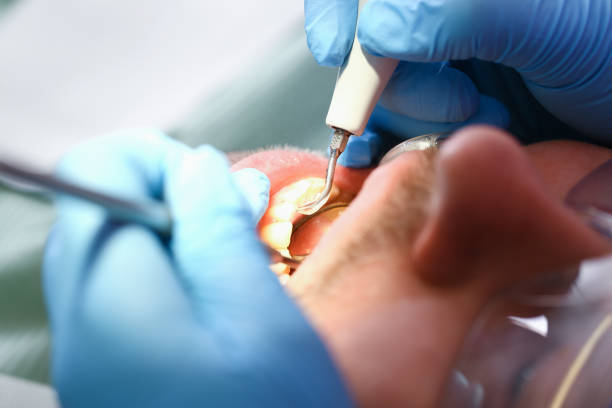 Best Emergency TMJ Treatment in East Merrimack, NH