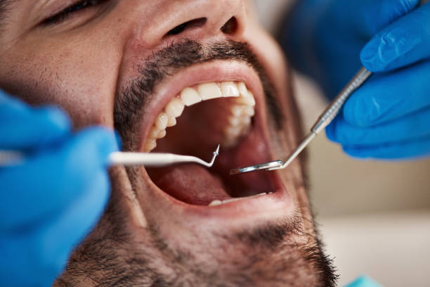 Best Emergency Tooth Extraction in East Merrimack, NH